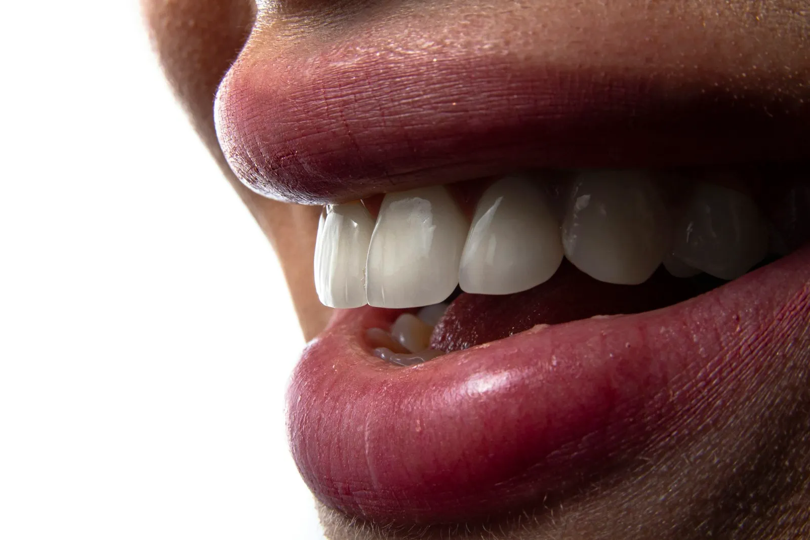 Illustration : dents qui tombent